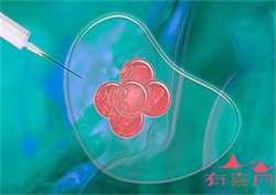 北京助孕中介哪里安全，北京治疗卵巢早衰医院有哪些