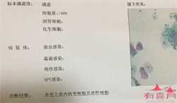 北京有没有代孕妇女,北京第三代孕妇试管医院排名怎么样？试管婴儿机构名单